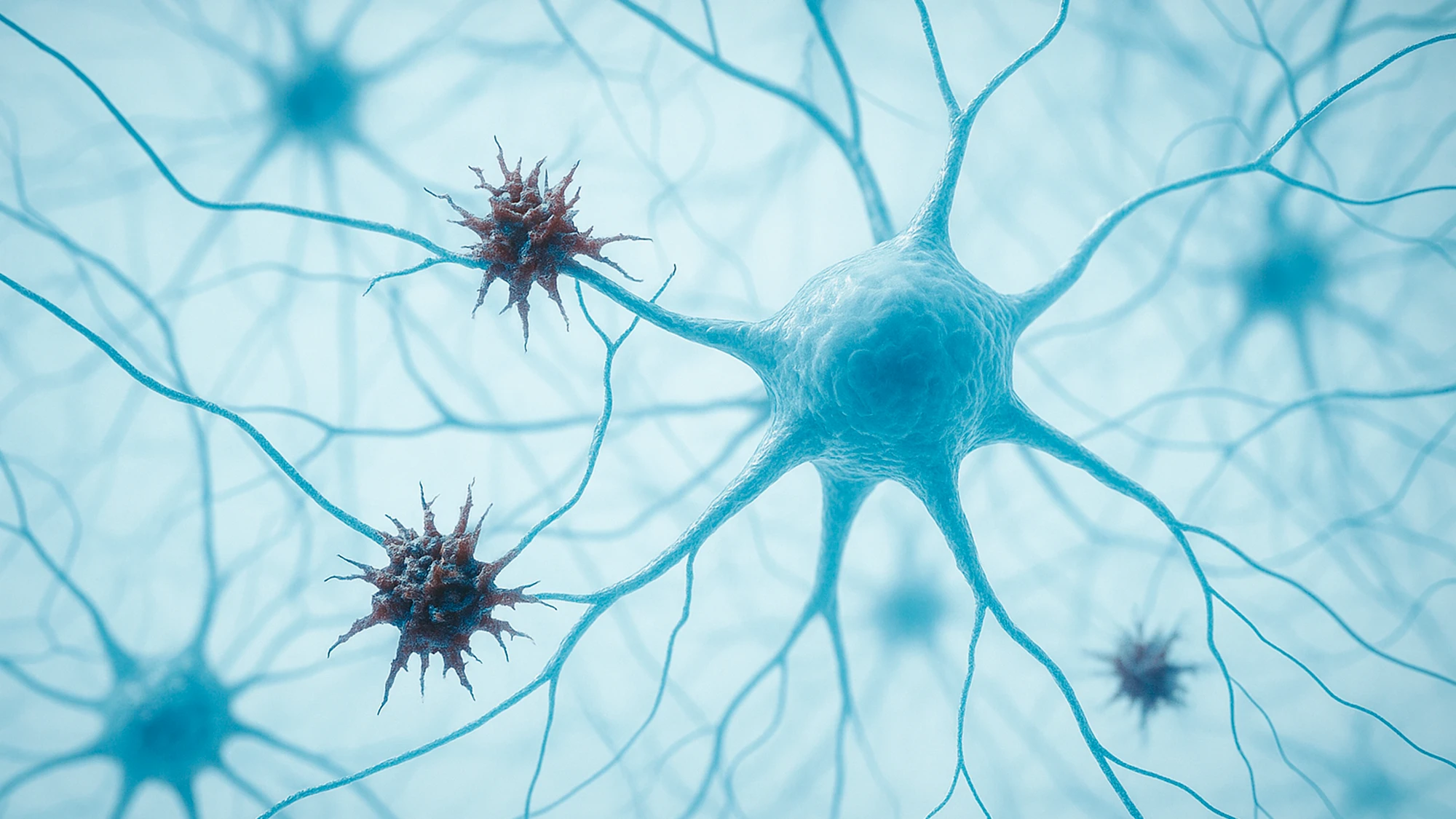 Representación realista de neuronas afectadas por Alzheimer en zonas de la memoria autobiográfica