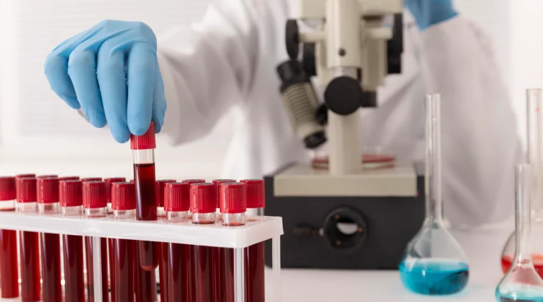 Representación de glóbulos rojos del tipo de sangre Rh nulo