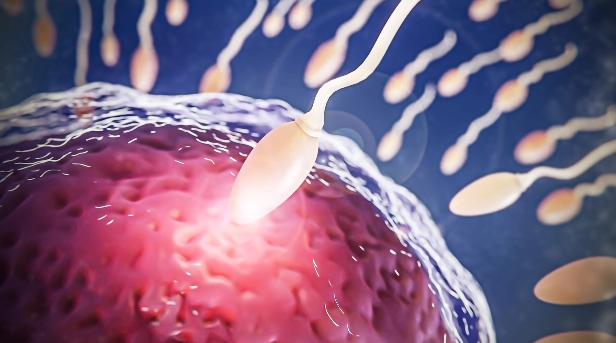 Ilustración científica del esperma humano mostrando cómo ciertas mutaciones genéticas pueden expandirse antes de la concepción